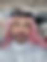 صورة العضو